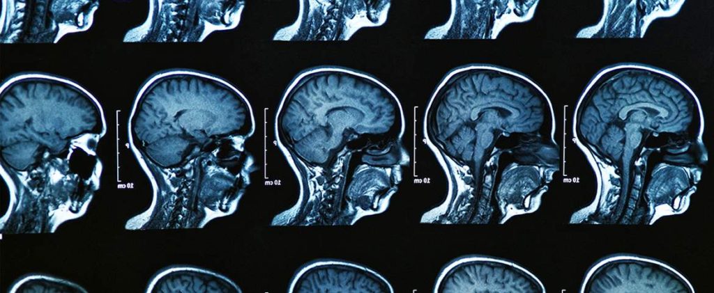Brain medical scans